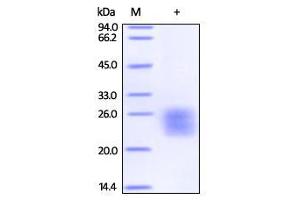 Biotinylated Human IL-6 on SDS-PAGE under reducing (R) condition. (IL-6 Protein (AA 30-212) (Biotin))