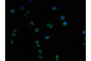 Immunofluorescence staining of A549 cells with ABIN7158014-IF at 1:100, counter-stained with DAPI.
