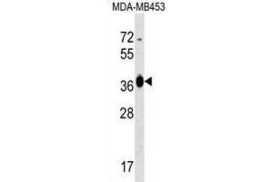Western Blotting (WB) image for anti-Glucose-Fructose Oxidoreductase Domain Containing 2 (GFOD2) antibody (ABIN2999227)