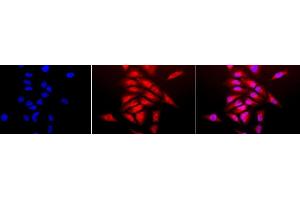 Immunocytochemistry/Immunofluorescence analysis using Rabbit Anti-SOD (Cu/Zn) Polyclonal Antibody (ABIN361651 and ABIN361652). (SOD1 anticorps)