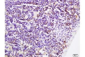 Formalin-fixed and paraffin embedded mouse spleen labeled with Rabbit Anti p53AIP1 Polyclonal Antibody, Unconjugated (ABIN872405) at 1:200 followed by conjugation to the secondary antibody and DAB staining