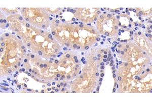 Detection of CASP8 in Human Kidney Tissue using Polyclonal Antibody to Caspase 8 (CASP8) (Caspase 8 anticorps  (AA 217-384))