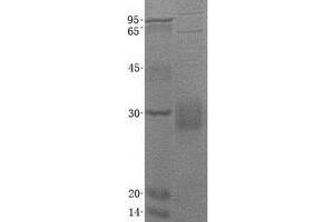 Validation with Western Blot (CD8B Protein (Transcript Variant 6) (His tag))