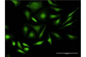 Immunofluorescence of monoclonal antibody to PRPF4B on HeLa cell. (PRPF4B anticorps  (AA 898-1005))