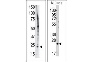 Image no. 1 for anti-BH3 Interacting Domain Death Agonist (BID) (BH3 Domain) antibody (ABIN356816) (BID anticorps  (BH3 Domain))
