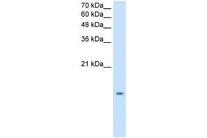 MGST2 antibody used at 1.