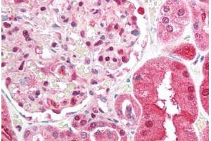 Human Kidney (formalin-fixed, paraffin-embedded) stained with BRCC3 antibody ABIN213911 at 5 ug/ml followed by biotinylated goat anti-rabbit IgG secondary antibody ABIN481713, alkaline phosphatase-streptavidin and chromogen. (BRCC3 anticorps  (N-Term))