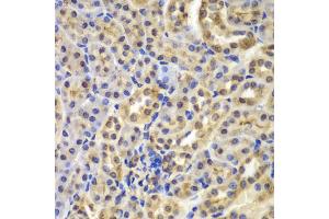 Immunohistochemistry of paraffin-embedded mouse kidney using NFKBIA antibody (ABIN4904526) at dilution of 1:100 (40x lens). (NFKBIA anticorps)