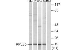 Western blot analysis of extracts from HeLa cells, Jurkat cells, COLO cells and 293 cells, using RPL35 antibody. (RPL35 anticorps  (Internal Region))
