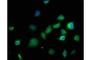 Immunofluorescence staining of SH-SY5Y cells with ABIN7150001 at 1:166, counter-stained with DAPI. (DPH5 anticorps  (AA 138-235))