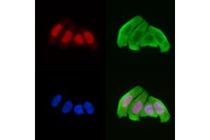 ABIN6257175 and ABIN6274526 staining Hela cells(30 min of UV treatment) by IF/ICC.