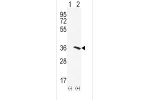Western blot analysis of NAT2 (arrow) using rabbit polyclonal NAT2 Antibody (C-term) (ABIN652275 and ABIN2841158).