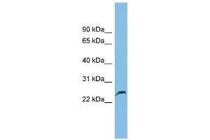 GSTK1 antibody used at 1 ug/ml to detect target protein. (GSTK1 anticorps  (Middle Region))
