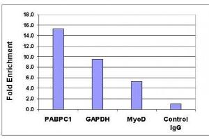 Histone H4K5ac antibody (pAb) tested by ChIP analysis. (Histone H4 anticorps  (acLys5))