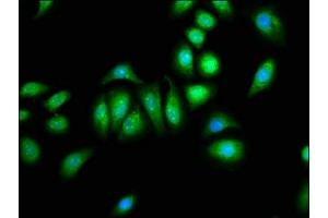 Immunofluorescence staining of A549 cells with ABIN7146392 at 1:133, counter-stained with DAPI. (PNPLA8 anticorps  (AA 158-345))