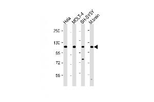 All lanes : Anti-KI Antibody (C-term) at 1:2000 dilution Lane 1: Hela whole cell lysate Lane 2: MOLT-4 whole cell lysate Lane 3: SH-SY5Y whole cell lysate Lane 4: Mouse brain lysate Lysates/proteins at 20 μg per lane. (ARHGAP39 anticorps  (C-Term))