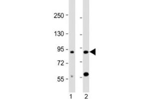 Western blot testing of human 1) brain and 2) HL-60 cell lysate with CCDC144A antibody at 1:2000. (CCDC144A anticorps  (AA 1257-1289))