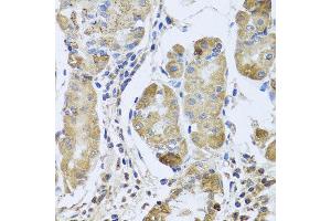 Immunohistochemistry of paraffin-embedded human gastric using EFHC1 antibody at dilution of 1:100 (x40 lens). (EFHC1 anticorps)