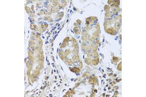 Immunohistochemistry of paraffin-embedded human gastric using EFHC1 antibody at dilution of 1:100 (x40 lens). (EFHC1 anticorps)