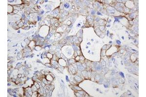 Image no. 2 for anti-ATP-Binding Cassette, Sub-Family B (MDR/TAP), Member 1 (ABCB1) (AA 995-1280) antibody (ABIN1491725)