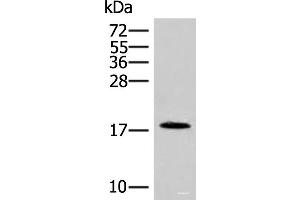 Western blot analysis of Human spleen tissue lysate using NHP2 Polyclonal Antibody at dilution of 1:400 (NHP2 anticorps)