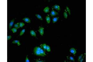 anti-ATPase, H+ Transporting, Lysosomal V0 Subunit A1 (ATP6V0A1) (AA 80-260), (Isoform 1) antibody