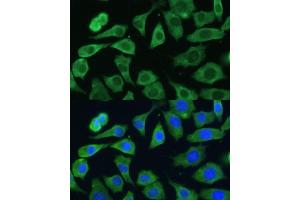 Immunofluorescence analysis of L-929 cells using EIF3D antibody (ABIN6130833, ABIN6140057, ABIN6140058 and ABIN6221638) at dilution of 1:100.