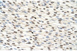 anti-Zinc Finger Protein 274 (ZNF274) (N-Term) antibody