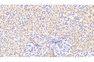 anti-Lysozyme (LYZ) (AA 19-148) antibody