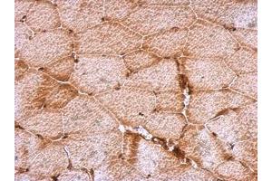 Image no. 1 for anti-Density-Regulated Protein (DENR) (AA 1-198) antibody (ABIN1501885)