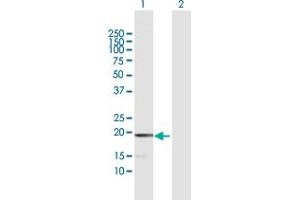 Western Blot analysis of MCEE expression in transfected 293T cell line by MCEE MaxPab polyclonal antibody. (MCEE anticorps  (AA 1-176))
