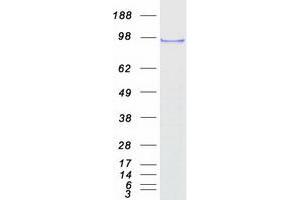 Validation with Western Blot