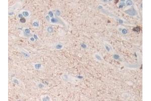 anti-Tubulin Polymerization Promoting Protein (Tppp) (AA 8-210) antibody