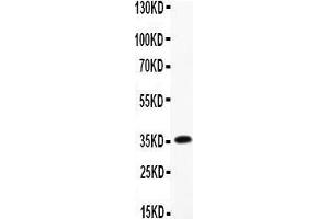 Western Blotting (WB) image for anti-CD68 Molecule (CD68) (AA 312-326), (Middle Region) antibody (ABIN3044428)
