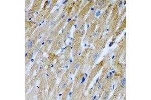 Immunohistochemical analysis of RCN2 staining in rat heart formalin fixed paraffin embedded tissue section. (RCN2 anticorps)