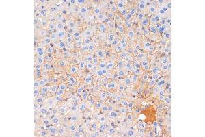 Immunohistochemistry of paraffin-embedded mouse liver using E-Cadherin antibody  at dilution of 1:100 (40x lens). (E-cadherin anticorps)