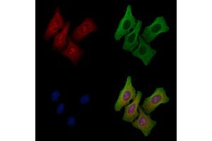 ABIN6258293 and ABIN6275329 staining Hela cells by IF/ICC. (NOLC1 anticorps  (C-Term))