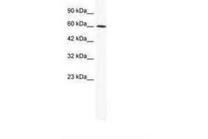 Image no. 1 for anti-Iroquois Homeobox Protein 1 (IRX1) (AA 123-172) antibody (ABIN202627) (IRX1 anticorps  (AA 123-172))