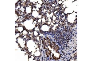 IHC analysis of delta 1 Catenin/CAS/CTNND1 using anti-delta 1 Catenin/CAS/CTNND1 antibody (ABIN7602221). (CTNND1 anticorps  (AA 64-930))