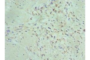 Immunohistochemistry of paraffin-embedded human gallbladder tissue using ABIN7150716 at dilution of 1:100