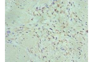 Immunohistochemistry of paraffin-embedded human gallbladder tissue using ABIN7150716 at dilution of 1:100 (MAP2K5 anticorps  (AA 1-190))