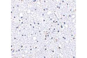 Immunohistochemistry of DARC in human brain tissue with DARC antibody at 5 μg/ml.