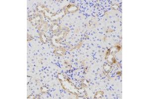 Immunohistochemistry (IHC) image for anti-ATG16 Autophagy Related 16-Like 1 (ATG16L1) antibody (ABIN1871137) (ATG16L1 anticorps)