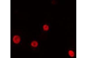 ABIN6275195 staining HeLa cells by IF/ICC. (NK2 Homeobox 4 anticorps  (Internal Region))