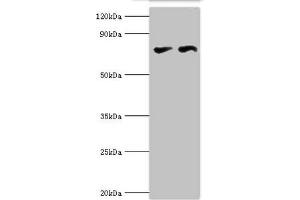 Western blot All lanes: Transcriptional repressor CTCF antibody at 6 μg/mL Lane 1: PC-3 whole cell lysate Lane 2: MCF-7 whole cell lysate Secondary Goat polyclonal to rabbit IgG at 1/10000 dilution Predicted band size: 83, 46 kDa Observed band size: 83 kDa (CTCF anticorps  (AA 1-260))