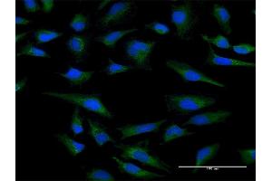 Immunofluorescence of purified MaxPab antibody to CYC1 on HeLa cell.