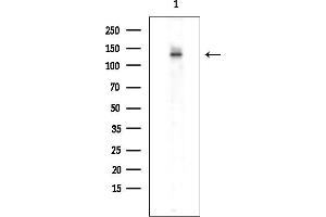 Western blot analysis of lysates from EC304 cells(heat-shock treatment), using SMG7 Antibody at 1/1000 dilution.