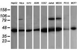 Western Blotting (WB) image for anti-Acetyl-CoA Acyltransferase 2 (ACAA2) antibody (ABIN2715630)