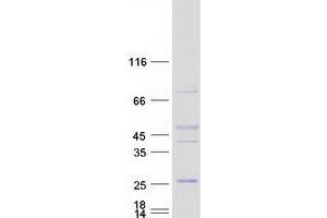 Validation with Western Blot