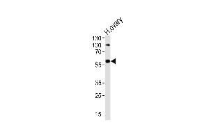 Western blot analysis of lysate from human ovary tissue lysate, using RYK Antibody  (ABIN392050 and ABIN2841818).